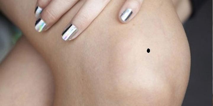 Nối ruồi ở đầu gối mang ý nghĩa gì? | Tử Vi Cổ Học