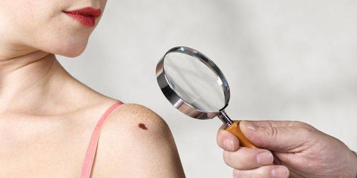 Nốt ruồi trên cánh tay phải đàn ông liệu có giàu sang | Tử Vi Cổ Học